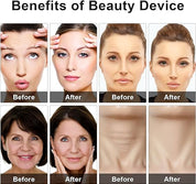 Eye Beauty Device